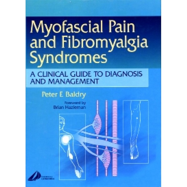 Myofascial Pain and Fibromyalgia Syndromes Herbs & Touch